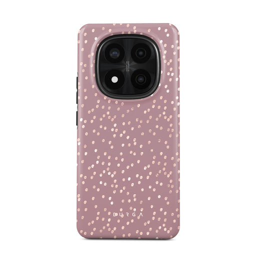 Hot Cocoa - Xiaomi Redmi Note 14 Pro 5G 手機殼