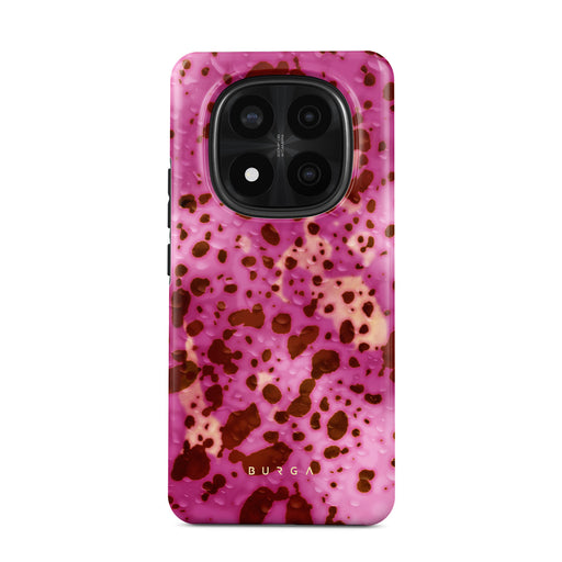 Orchid - Xiaomi Redmi Note 14 Pro 5G 手機殼