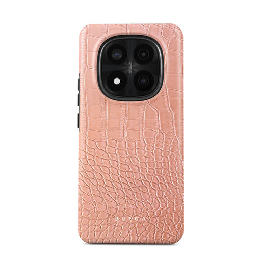 Pink Croco - Xiaomi Redmi Note 14 Pro+ 5G 手機殼