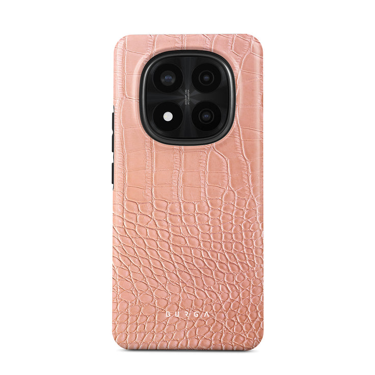 Pink Croco - Xiaomi Redmi Note 14 Pro+ 5G 手機殼